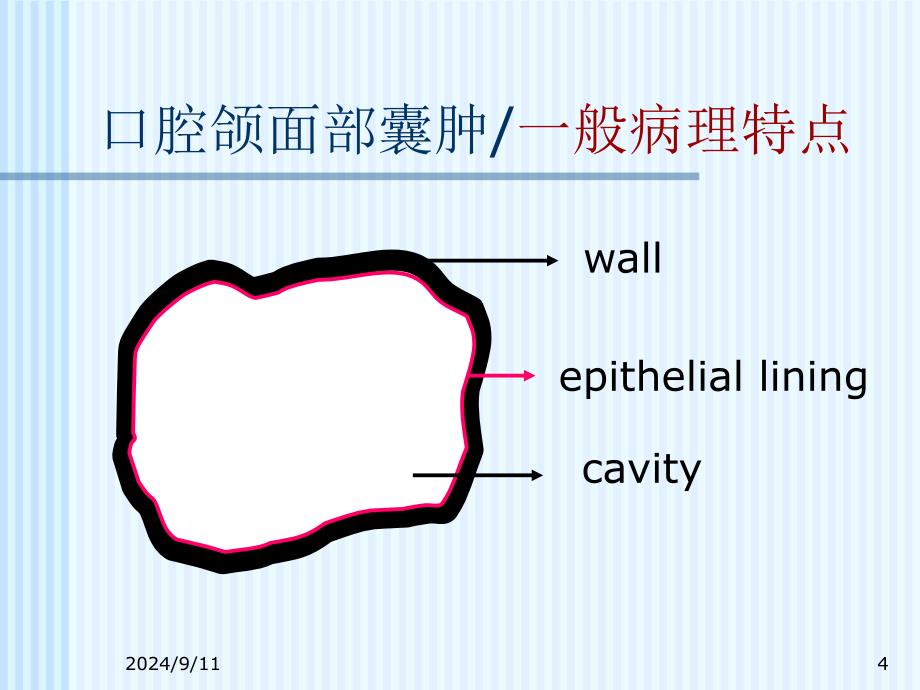 《口腔颌面部囊肿》PPT课件_第4页