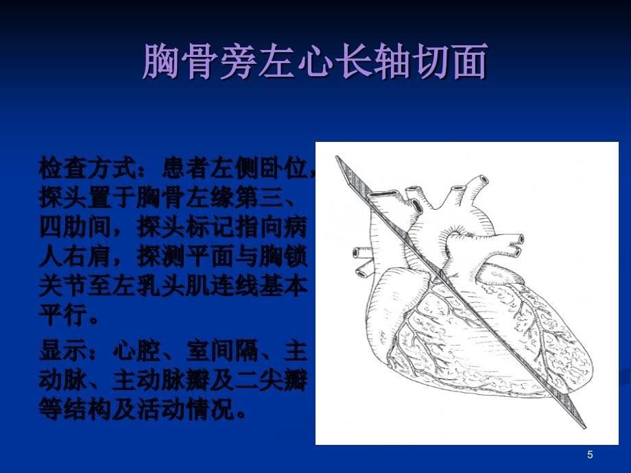 正常心脏超声诊断课件_第5页