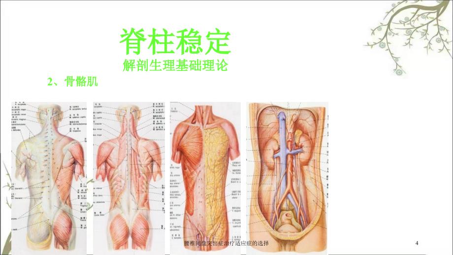 腰椎间盘突出症治疗适应症的选择课件_第4页