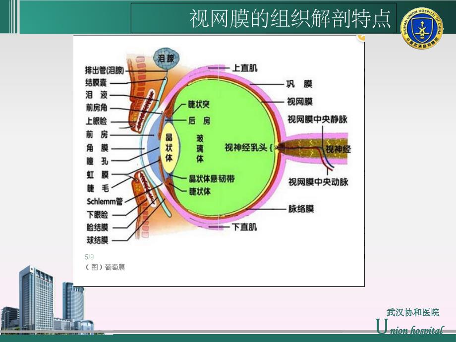 视网膜动脉阻塞的急救与护理修改.ppt_第4页