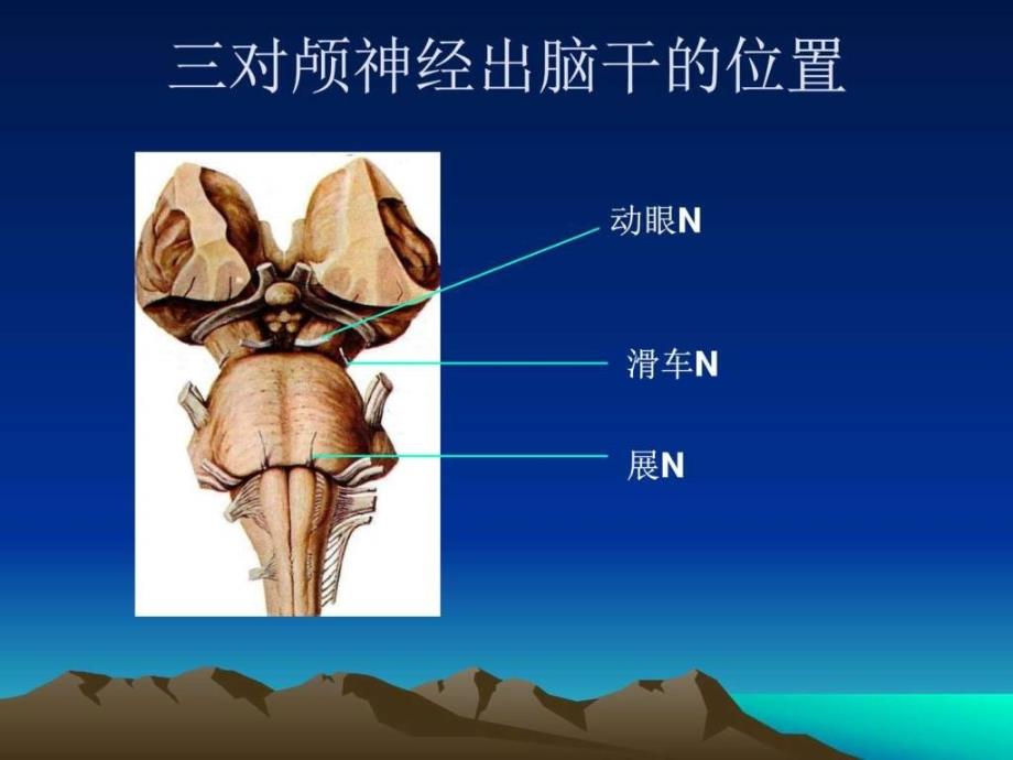 痛性眼肌麻痹临床医学医药卫生专业资料.ppt_第3页