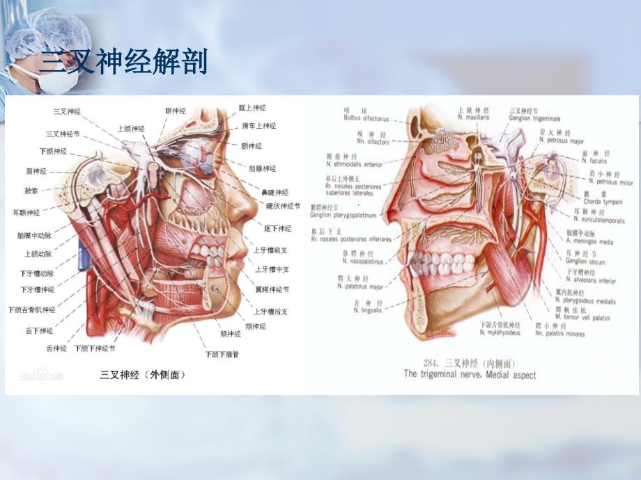 三叉神经解剖及三叉神经痛影像诊断（行业荟萃）_第4页