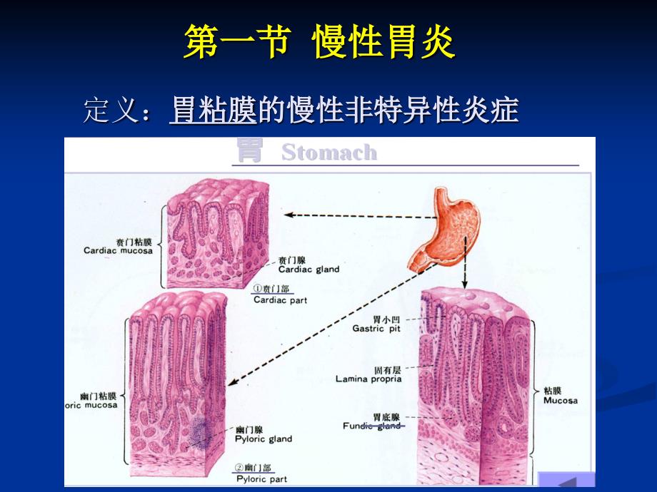 病理学教学课件：胃炎、胃溃疡_第1页