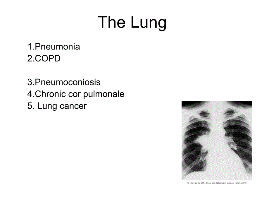 医学教学课件：The Lung_第1页