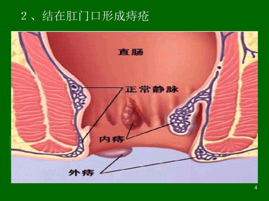 富氢水与疾病治疗_第4页