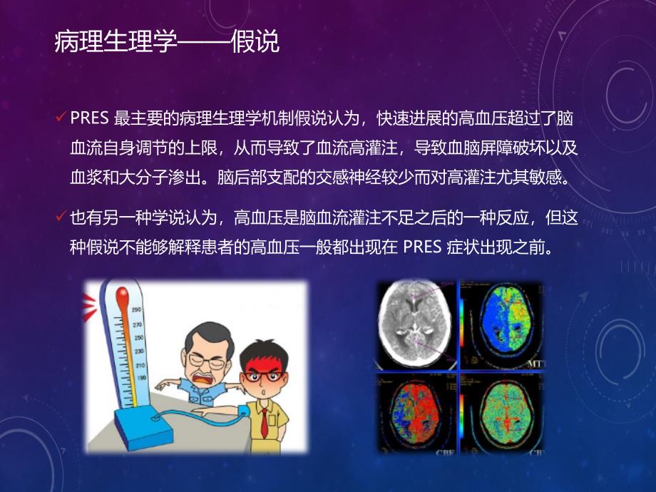 可逆性后部白质脑病.ppt_第4页