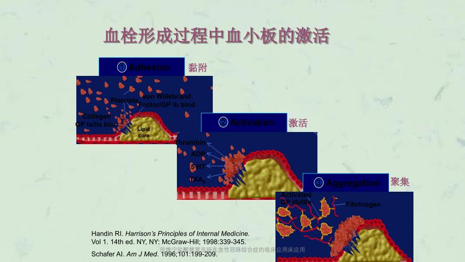 欣维宁盐酸替罗非班在急性冠脉综合症的临床应用床应用课件_第3页