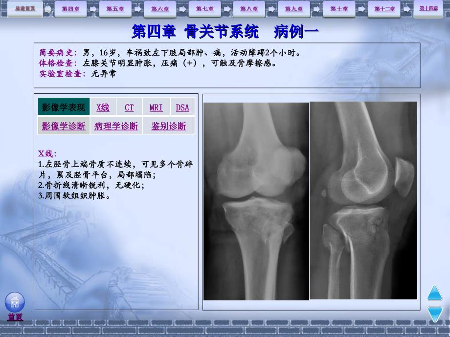 骨骼肌肉系统影像诊断病例分享_第3页