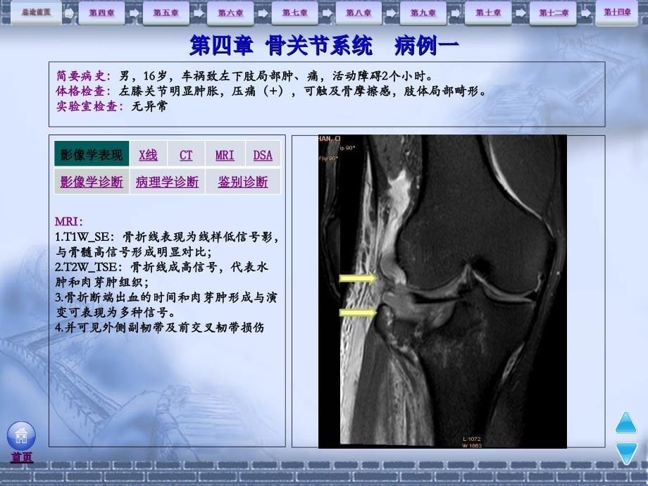 骨骼肌肉系统影像诊断病例分享_第5页