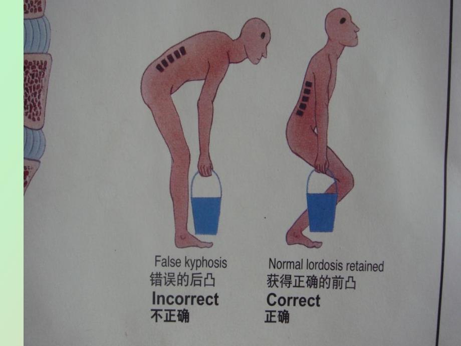 椎间盘突出的预防保健_第4页