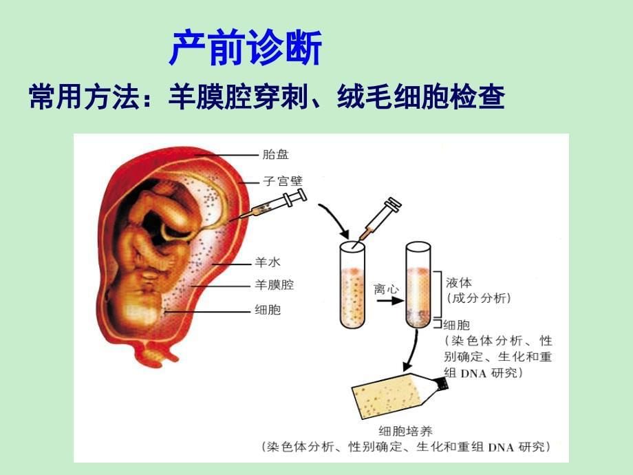 U盘 遗传咨询与优生,基因治疗和人类基因组计划 Microsoft Office PowerPoint 演示文稿_第5页