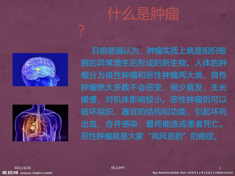 肿瘤健康教育知识讲座医学课件_第4页