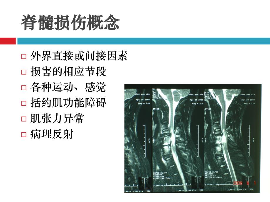 最新脊髓损伤概述_第3页