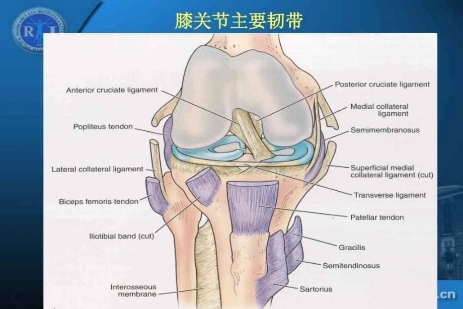 36膝关节韧带损伤的MR诊断－丁晓毅dxy_第5页