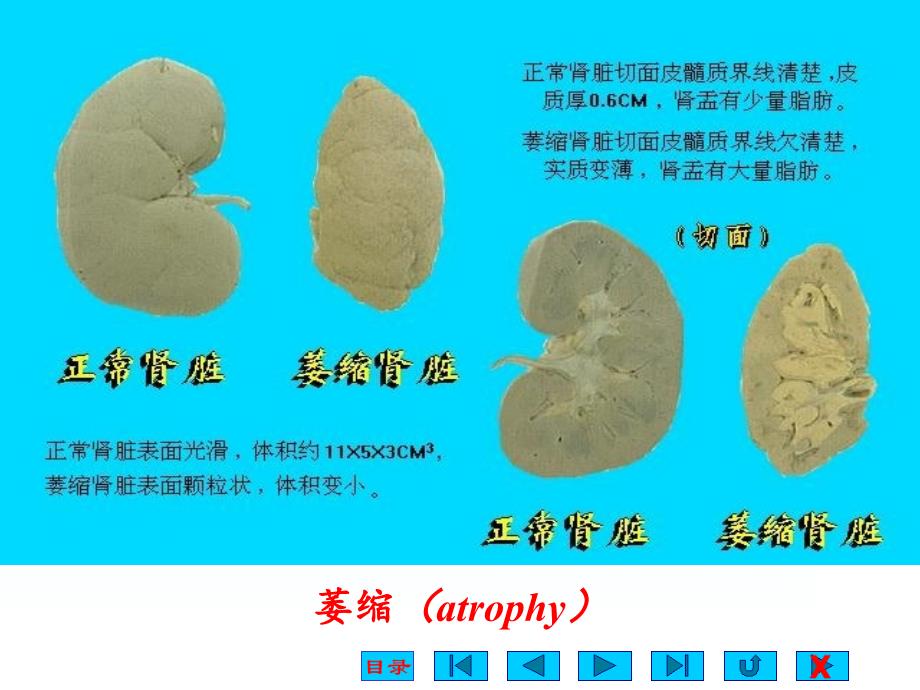 适应损伤与修复课件_第3页