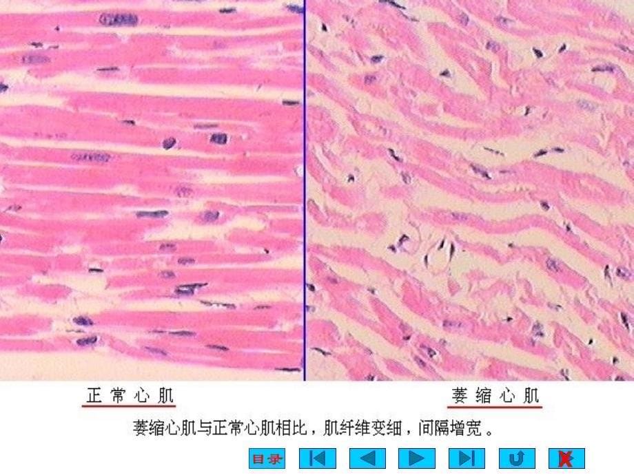 适应损伤与修复课件_第5页