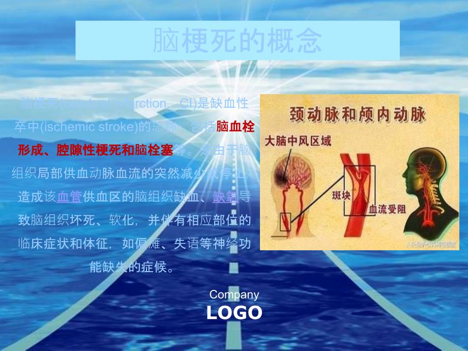 脑梗死的处理流程ppt_第4页