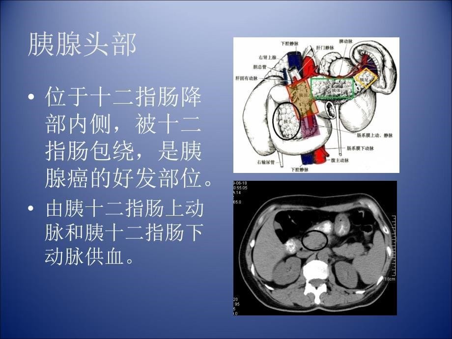 胰腺肿瘤影像学诊断.ppt_第5页