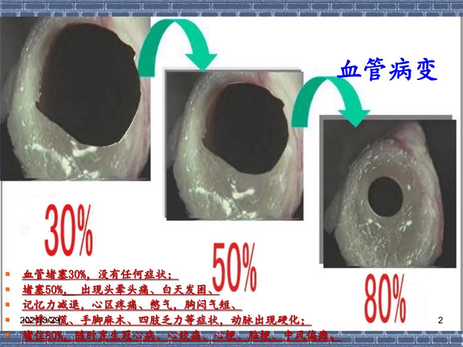 三高四病讲稿课堂PPT_第2页