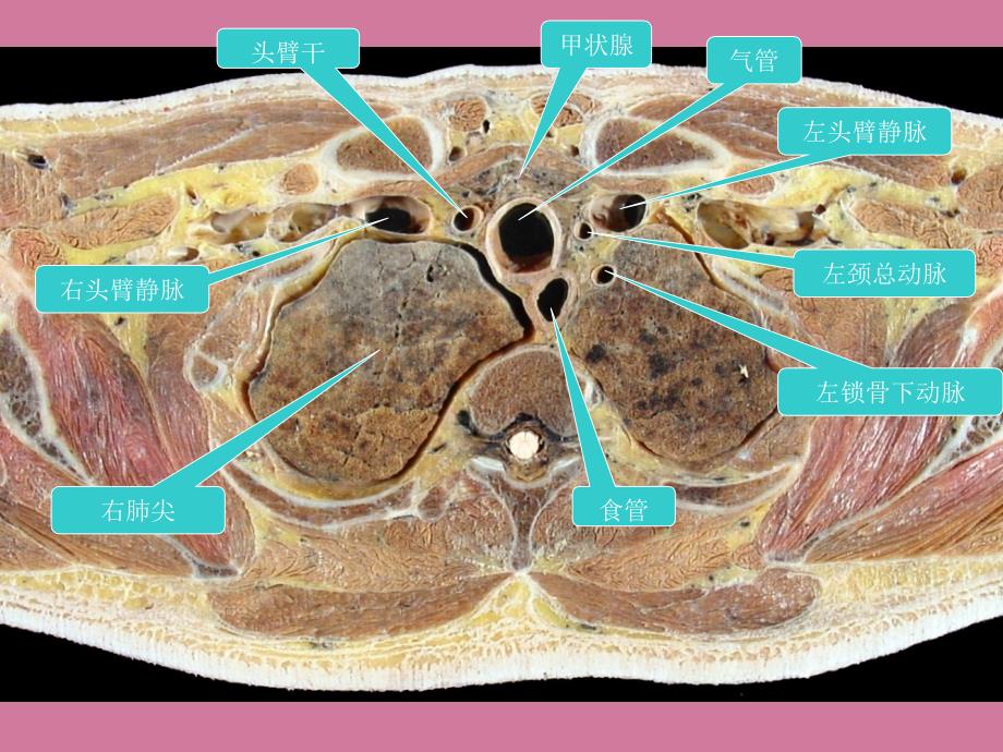 胸部的横断层解剖课件ppt课件_第3页