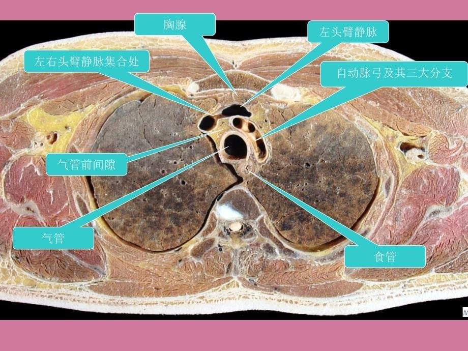 胸部的横断层解剖课件ppt课件_第5页