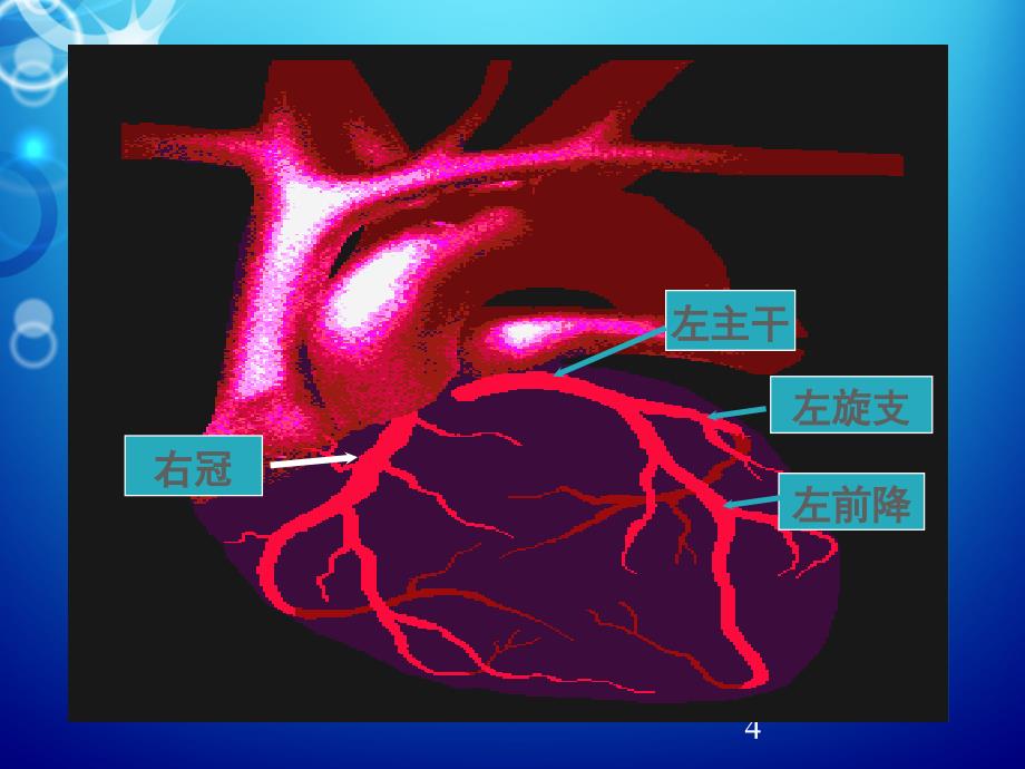 冠心病的中医养生_第4页