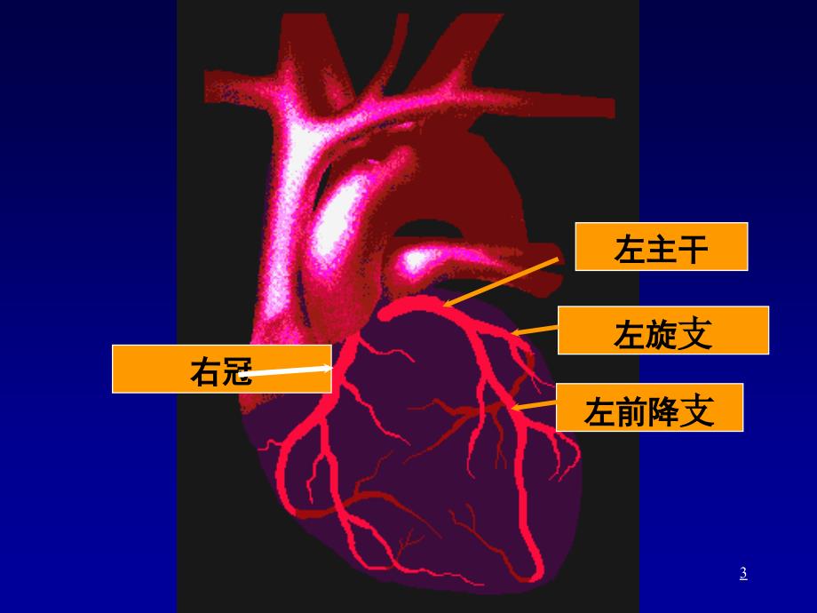 冠心病教学要PPT_第3页