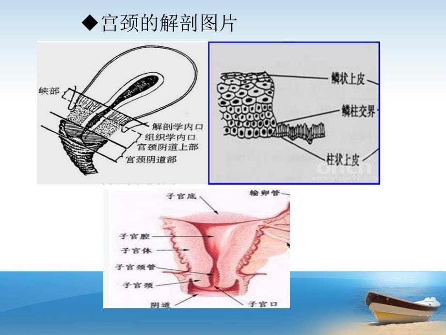 《宫颈癌防治知识》PPT课件.ppt_第5页