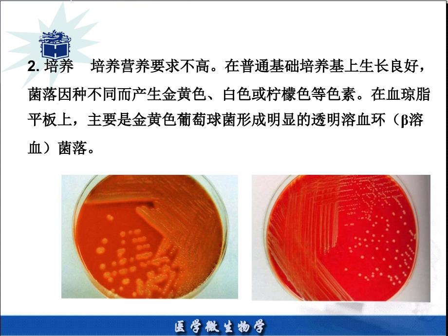 医学微生物8章_第4页