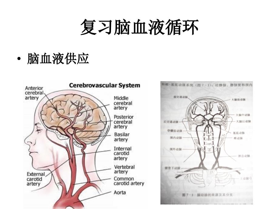 最新脑血管疾病的营养PPT文档_第3页