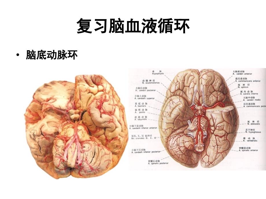 最新脑血管疾病的营养PPT文档_第4页