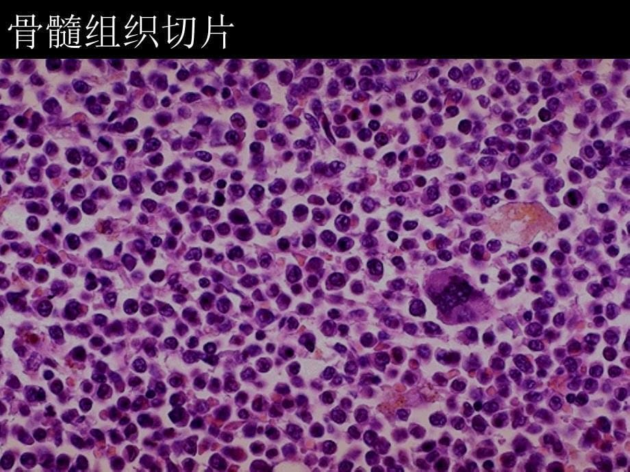 临床血液学检验第5讲骨髓活检及细胞生物学实验技术_第5页