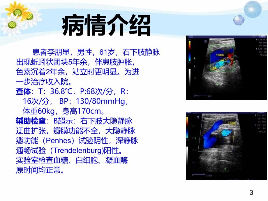 大隐静脉曲张护理查房于新彤_第3页