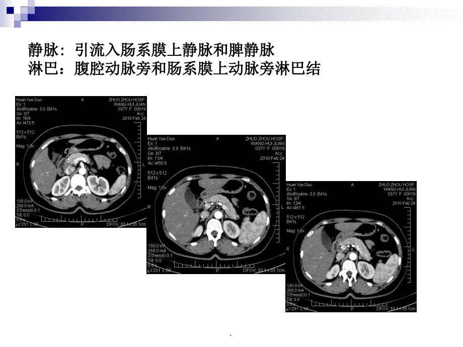 胰腺癌综合诊治中国专家共识PPT演示课件_第4页