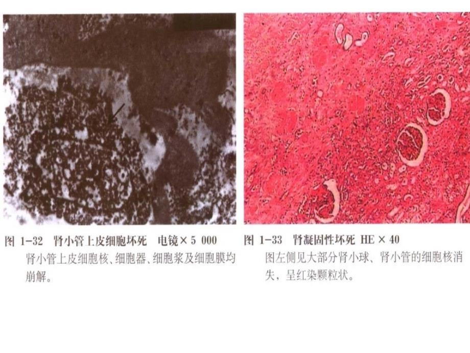 《医学病理图谱》PPT课件_第3页