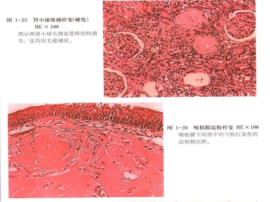 《医学病理图谱》PPT课件_第4页