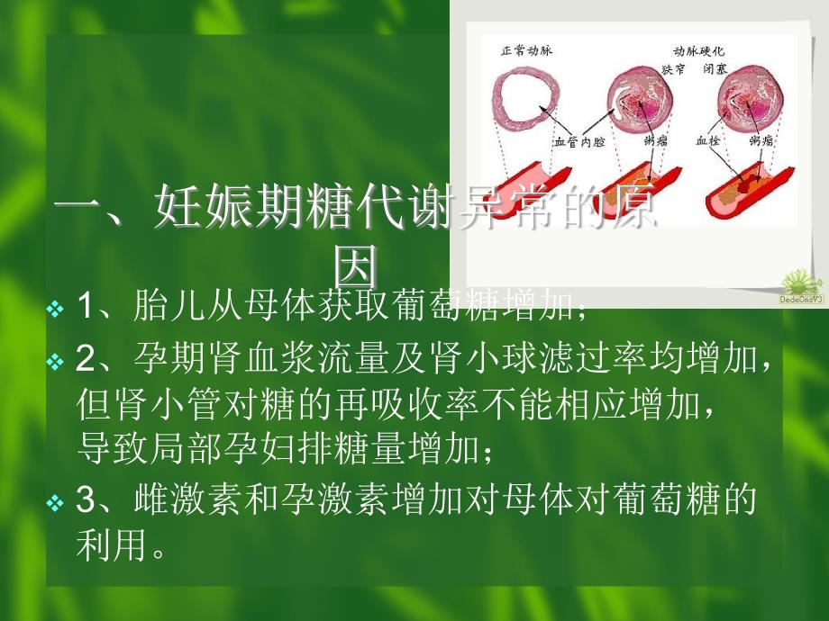 妊娠期糖尿病刘红ppt课件_第4页