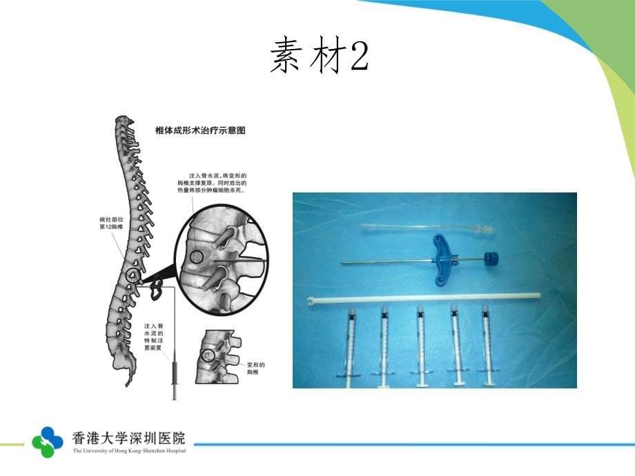 经典骨水泥术中调配须知_第5页