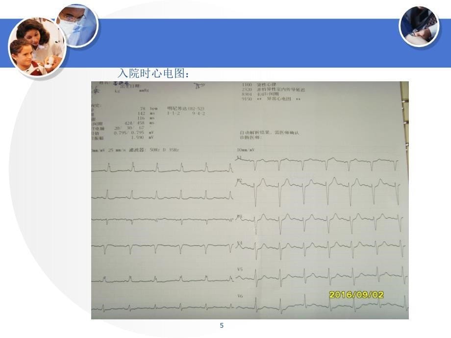 三度房室传导阻滞_第5页