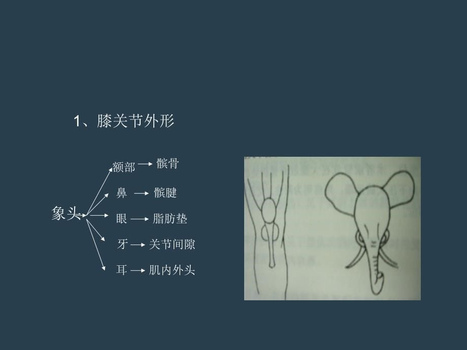 膝关节疼痛预防治疗课件_第5页