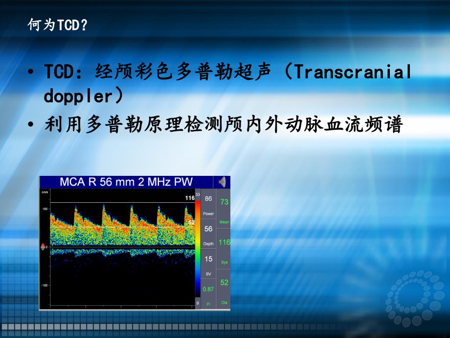 TCD与临床ppt课件.ppt_第3页