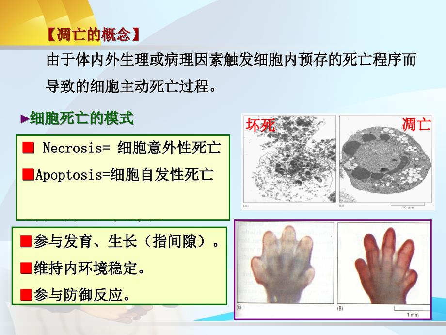 医学课件第9章细胞凋亡与疾病_第2页