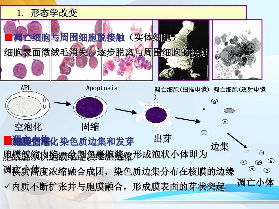 医学课件第9章细胞凋亡与疾病_第4页