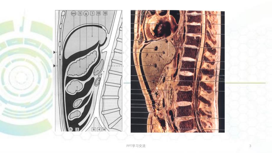 腹膜腔腹膜后CT检查ppt课件_第3页