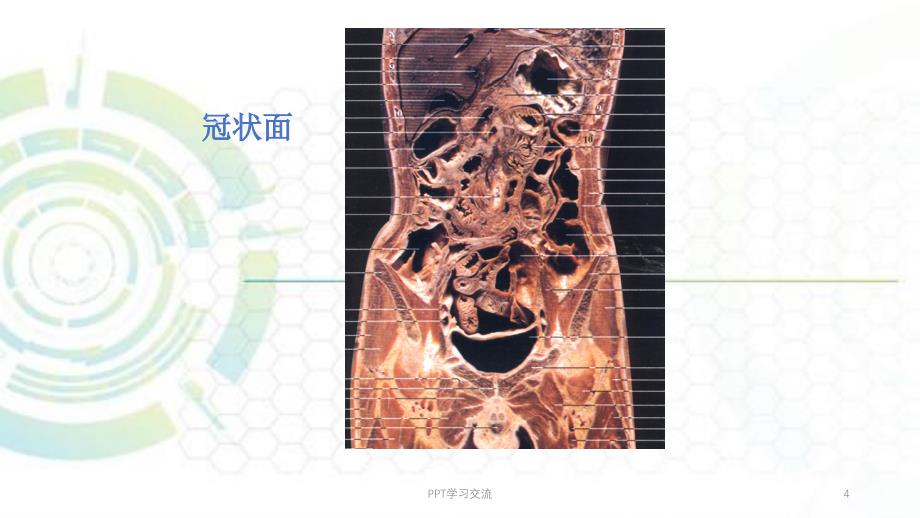 腹膜腔腹膜后CT检查ppt课件_第4页