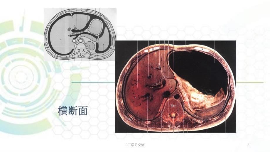 腹膜腔腹膜后CT检查ppt课件_第5页