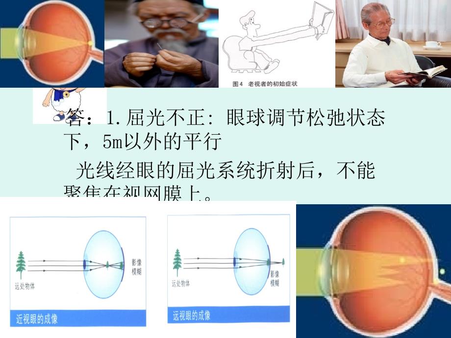 正确认识验光单课件_第3页