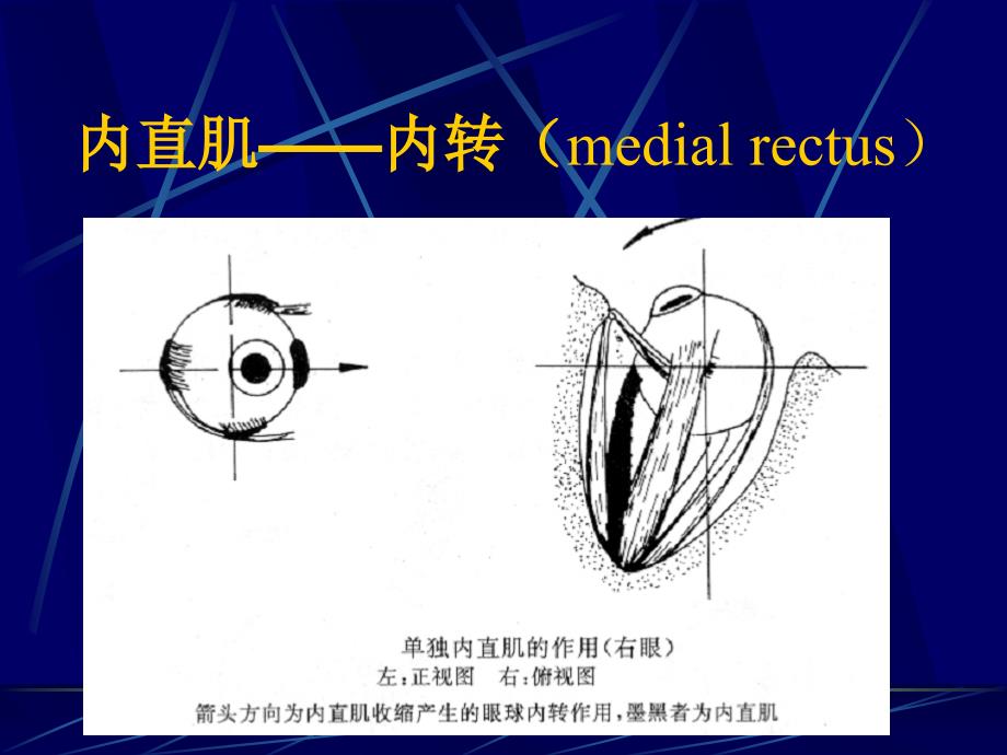 斜视和弱视(眼科学课件)_第4页