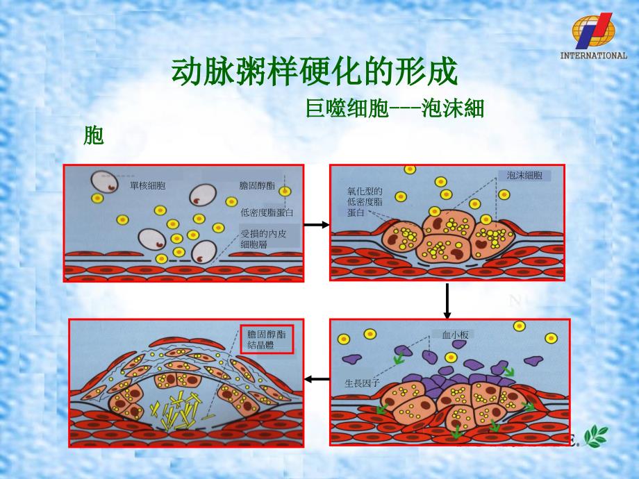 安利课件系列心血管营养2危险因素_第4页