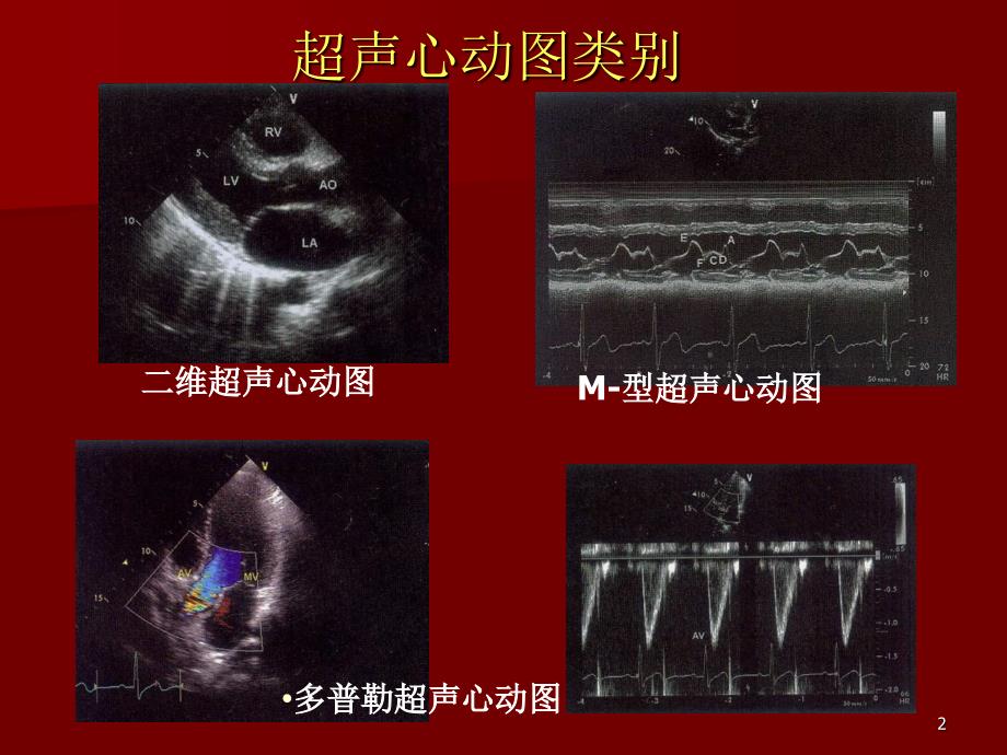 如何解读超声心动图PPT参考幻灯片_第2页